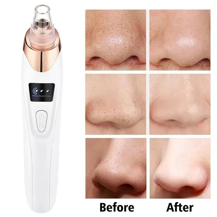 Upgraded Electric Blackhead Remover Vacuum – Facial Pore Cleaner & Acne Extractor Tool with 5 Probes for Women & Men
